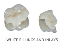 Fillings