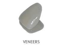 Venners