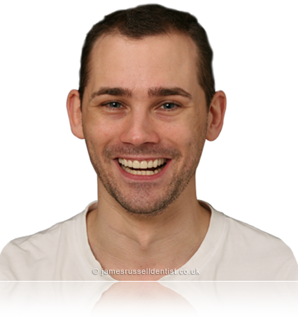 Smile Makeover Banner